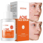 Remove Acne Face Serum – 24 Hours Visible Result
