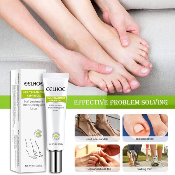 (2 Pis) Nail Repair and Fungus Treatment Solution - Image 4