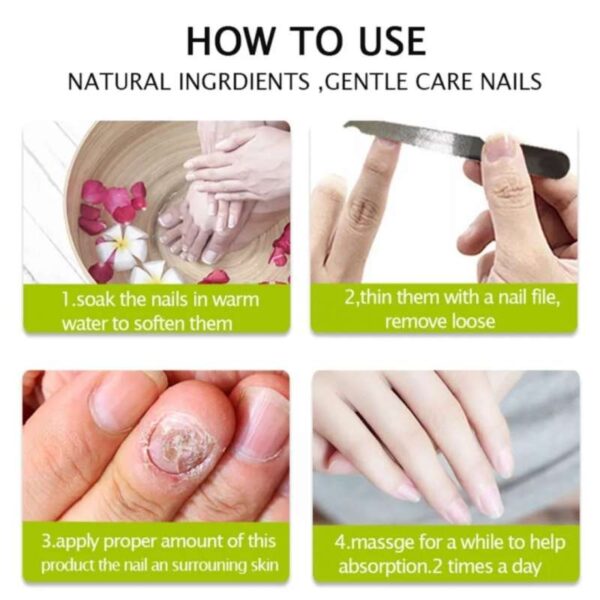 (2 Pis) Nail Repair and Fungus Treatment Solution - Image 2